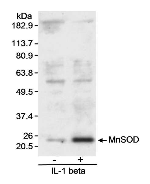 SOD2 / Mn SOD Antibody - Detection of MnSOD by Western Blot. Samples: Whole cell lysate (30 ug) from rat vascular smooth muscle cells left untreated (-) or treated with IL-1 beta (3 ng/ml) for 24 hours. Antibody: Affinity purified goat anti-MnSOD used at 0.4 ug/ml. Detection: Chemiluminescence with 3 minute exposure.