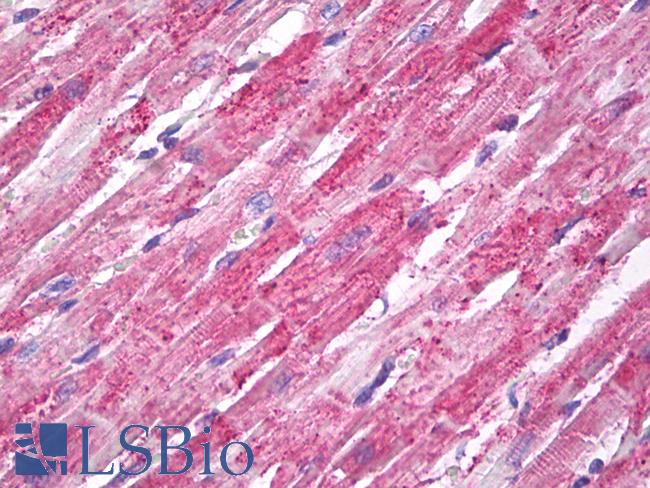 SOD2 / Mn SOD Antibody - Anti-MNSOD / SOD2 antibody IHC of human heart. Immunohistochemistry of formalin-fixed, paraffin-embedded tissue after heat-induced antigen retrieval. Antibody dilution 10 ug/ml.  This image was taken for the unconjugated form of this product. Other forms have not been tested.