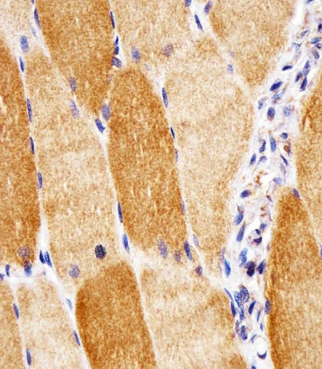 SOD2 / Mn SOD Antibody - Antibody staining SODM in human skeletal muscle sections by Immunohistochemistry (IHC-P - paraformaldehyde-fixed, paraffin-embedded sections). Tissue was fixed with formaldehyde and blocked with 3% BSA for 0. 5 hour at room temperature; antigen retrieval was by heat mediation with a citrate buffer (pH 6). Samples were incubated with primary antibody (1/25) for 1 hours at 37°C. A undiluted biotinylated goat polyvalent antibody was used as the secondary antibody.