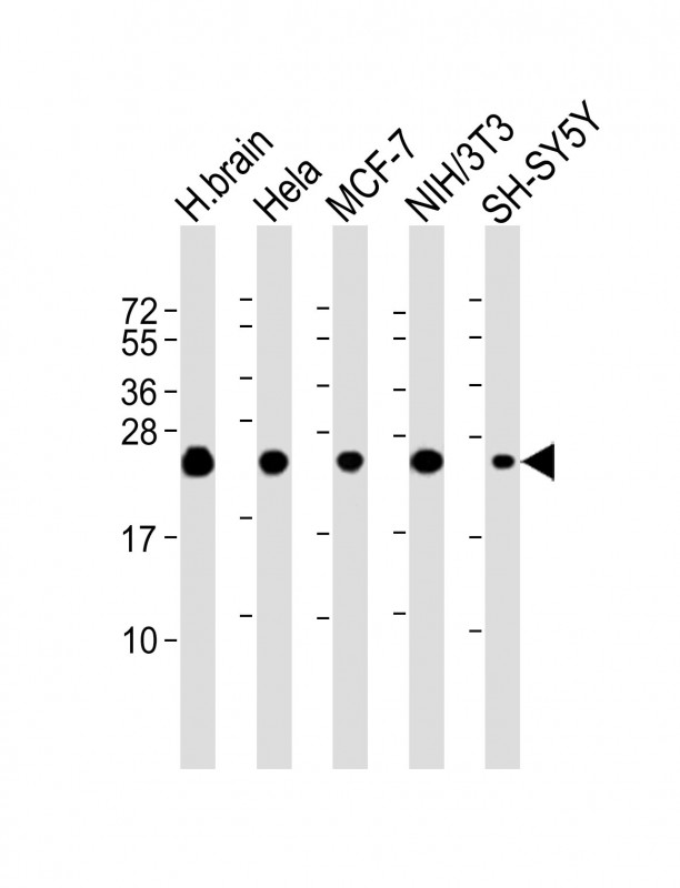 SOD2 / Mn SOD Antibody - All lanes: Anti-SODM Antibody at 1:2000 dilution. Lane 1: human brain lysate. Lane 2: HeLa whole cell lysate. Lane 3: MCF-7 whole cell lysate. Lane 4: NIH/3T3 whole cell lysate. Lane 5: SH-SY5Y whole cell lysate Lysates/proteins at 20 ug per lane. Secondary Goat Anti-mouse IgG, (H+L), Peroxidase conjugated at 1:10000 dilution. Predicted band size: 25 kDa. Blocking/Dilution buffer: 5% NFDM/TBST.