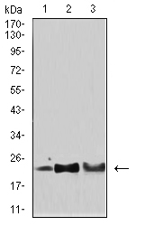 SOD2 / Mn SOD Antibody - Western blot analysis using SOD2 mouse mAb against Hela (1), HepG2 (2), and SH-SY5Y (3) cell lysate.