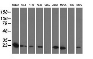 SOD2 / Mn SOD Antibody - Western blot of extracts (35 ug) from 9 different cell lines by using anti-SOD2 monoclonal antibody.