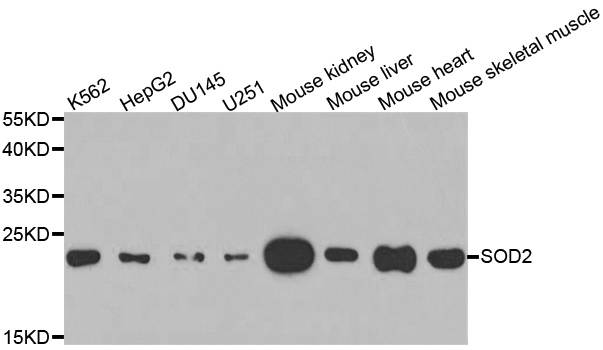 SOD2 / Mn SOD Antibody - Western blot analysis of extracts of various cell lines, using SOD2 antibody at 1:1000 dilution. The secondary antibody used was an HRP Goat Anti-Rabbit IgG (H+L) at 1:10000 dilution. Lysates were loaded 25ug per lane and 3% nonfat dry milk in TBST was used for blocking.
