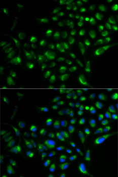 SOD2 / Mn SOD Antibody - Immunofluorescence analysis of HeLa cells using SOD2 antibody. Blue: DAPI for nuclear staining.