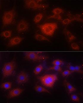 SOD2 / Mn SOD Antibody - Immunofluorescence analysis of PC-12 cells using SOD2 antibodyat dilution of 1:100 (40x lens). Blue: DAPI for nuclear staining.