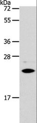 SOD2 / Mn SOD Antibody - Western blot analysis of Mouse liver tissue, using SOD2 Polyclonal Antibody at dilution of 1:950.
