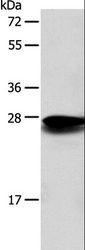 SOD2 / Mn SOD Antibody - Western blot analysis of Mouse liver tissue, using SOD2 Polyclonal Antibody at dilution of 1:650.