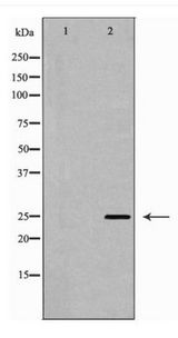 SOD2 / Mn SOD Antibody - Western blot of sod2 expression in Mouse Spinal Cord lysate