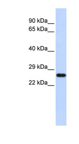 SOD2 / Mn SOD Antibody - SOD2 / MNSOD antibody Western blot of Placenta lysate. This image was taken for the unconjugated form of this product. Other forms have not been tested.