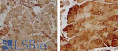 SOD2 / Mn SOD Antibody - IHC localization of Mn SOD within the muscle fibres of LPS-injected rats (Left: Untreated, Right: treated with 3mmol*kg-1 NAC).  This image was taken for the unconjugated form of this product. Other forms have not been tested.