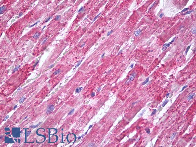 SOD2 / Mn SOD Antibody - Anti-MNSOD / SOD2 antibody IHC of human heart. Immunohistochemistry of formalin-fixed, paraffin-embedded tissue after heat-induced antigen retrieval. Antibody dilution 10 ug/ml.  This image was taken for the unconjugated form of this product. Other forms have not been tested.