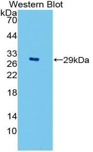 SOD3 Antibody - Western blot of recombinant SOD3.