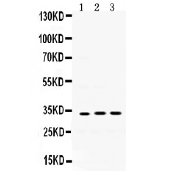SOD3 Antibody - SOD3 antibody Western blot. All lanes: Anti SOD3 at 0.5 ug/ml. Lane 1: Mouse Lung Tissue Lysate at 50 ug. Lane 2: Mouse Kidney Tissue Lysate at 50 ug. Lane 3: Mouse Cardiac Muscle Tissue Lysate at 50 ug. Predicted band size: 32 kD. Observed band size: 32 kD.