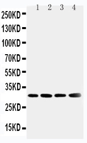 SOD3 Antibody - WB of SOD3 antibody. Lane 1: Human Placenta Tissue Lysate. Lane 2: A549 Cell Lysate. Lane 3: MM231 Cell Lysate. Lane 4: MCF-7 Cell Lysate.