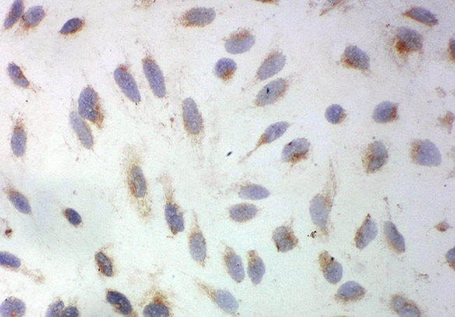 SOD3 Antibody - ICC analysis of SOD3 using anti-SOD3 antibody. SOD3 was detected in immunocytochemical section of HELA cell. Heat mediated antigen retrieval was performed in citrate buffer (pH6, epitope retrieval solution) for 20 mins. The tissue section was blocked with 10% goat serum. The tissue section was then incubated with 1µg/ml rabbit anti-SOD3 Antibody overnight at 4°C. Biotinylated goat anti-rabbit IgG was used as secondary antibody and incubated for 30 minutes at 37°C. The tissue section was developed using Strepavidin-Biotin-Complex (SABC) with DAB as the chromogen.