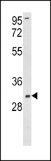SOD3 Antibody - Western blot of SOD3 Antibody in K562 cell line lysates (35 ug/lane). SOD3 (arrow) was detected using the purified antibody.