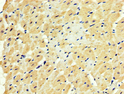 SOD3 Antibody - IHC image of SOD3 Antibody diluted at 1:500 and staining in paraffin-embedded human heart tissue performed on a Leica BondTM system. After dewaxing and hydration, antigen retrieval was mediated by high pressure in a citrate buffer (pH 6.0). Section was blocked with 10% normal goat serum 30min at RT. Then primary antibody (1% BSA) was incubated at 4°C overnight. The primary is detected by a biotinylated secondary antibody and visualized using an HRP conjugated SP system.