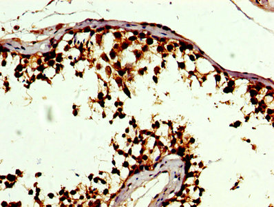 SOD3 Antibody - IHC image of SOD3 Antibody diluted at 1:500 and staining in paraffin-embedded human testis tissue performed on a Leica BondTM system. After dewaxing and hydration, antigen retrieval was mediated by high pressure in a citrate buffer (pH 6.0). Section was blocked with 10% normal goat serum 30min at RT. Then primary antibody (1% BSA) was incubated at 4°C overnight. The primary is detected by a biotinylated secondary antibody and visualized using an HRP conjugated SP system.