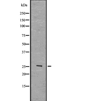 SOD3 Antibody - Western blot analysis of SOD-3 using HuvEc whole lysates.