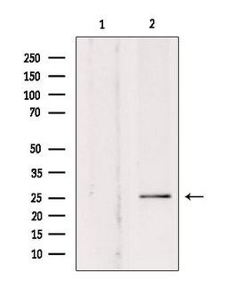 SOD3 Antibody - Western blot analysis of extracts of rat brain tissue using SOD-3 antibody. Lane 1 was treated with the blocking peptide.
