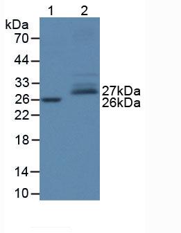 SOD3 Antibody - Western blot of human serum (lane 1) and human lung tissue (lane 2).