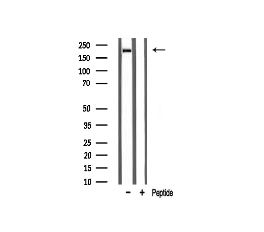 Sodium Channel Antibody - Western blot analysis on rat muscle tissue lysate using Sodium Channel-pan antibody