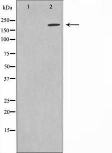 Sodium Channel Antibody - Western blot analysis on HuvEc cell lysates using Sodium Channel-pan antibody. The lane on the left is treated with the antigen-specific peptide.