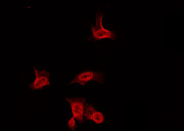 Sodium Channel Antibody - Staining HuvEc cells by IF/ICC. The samples were fixed with PFA and permeabilized in 0.1% Triton X-100, then blocked in 10% serum for 45 min at 25°C. The primary antibody was diluted at 1:200 and incubated with the sample for 1 hour at 37°C. An Alexa Fluor 594 conjugated goat anti-rabbit IgG (H+L) Ab, diluted at 1/600, was used as the secondary antibody.