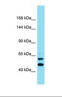 SOGA1 Antibody - Western blot of OVCAR-3. KIAA1045 antibody dilution 1.0 ug/ml.  This image was taken for the unconjugated form of this product. Other forms have not been tested.