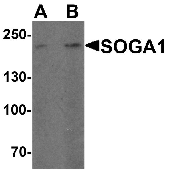 SOGA1 Antibody - Western blot analysis of SOGA1 in HeLa cell lysate with SOGA1 antibody at (A) 1 and (B) 2 ug/ml.