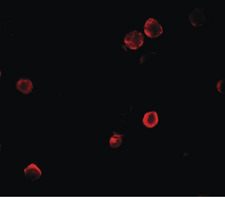 SOGA1 Antibody - Immunofluorescence of SOGA1 in HeLa cells with SOGA1 antibody at 5 ug/ml.