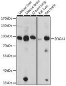 SOGA1 Antibody - Western blot analysis of extracts of various cell lines using SOGA1 Polyclonal Antibody at dilution of 1:1000.