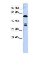 SOHLH1 Antibody - Western blot of Human 293T. SOHLH1 antibody dilution 1.0 ug/ml.  This image was taken for the unconjugated form of this product. Other forms have not been tested.