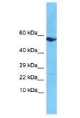 SOHLH2 Antibody - SOHLH2 antibody Western Blot of MDA-MB-435s. Antibody dilution: 1 ug/ml.  This image was taken for the unconjugated form of this product. Other forms have not been tested.