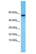 SOHLH2 Antibody - SOHLH2 antibody Western Blot of Fetal Lung. Antibody dilution: 1 ug/ml.  This image was taken for the unconjugated form of this product. Other forms have not been tested.