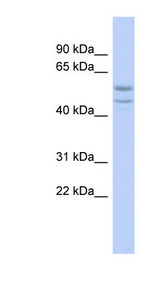 SOHLH2 Antibody - SOHLH2 antibody Western blot of OVCAR-3 cell lysate. This image was taken for the unconjugated form of this product. Other forms have not been tested.