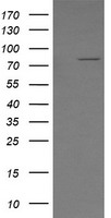 SOLO / SESTD1 Antibody - HEK293T cells were transfected with the pCMV6-ENTRY control (Left lane) or pCMV6-ENTRY SESTD1 (Right lane) cDNA for 48 hrs and lysed. Equivalent amounts of cell lysates (5 ug per lane) were separated by SDS-PAGE and immunoblotted with anti-SESTD1.