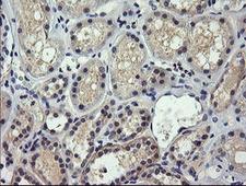 SOLO / SESTD1 Antibody - IHC of paraffin-embedded Human Kidney tissue using anti-SESTD1 mouse monoclonal antibody.