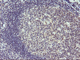 SOLO / SESTD1 Antibody - IHC of paraffin-embedded Human tonsil using anti-SESTD1 mouse monoclonal antibody.