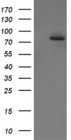 SOLO / SESTD1 Antibody - HEK293T cells were transfected with the pCMV6-ENTRY control (Left lane) or pCMV6-ENTRY SESTD1 (Right lane) cDNA for 48 hrs and lysed. Equivalent amounts of cell lysates (5 ug per lane) were separated by SDS-PAGE and immunoblotted with anti-SESTD1.