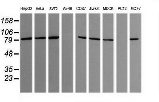 SOLO / SESTD1 Antibody - Western blot of extracts (35 ug) from 9 different cell lines by using g anti-SESTD1 monoclonal antibody (HepG2: human; HeLa: human; SVT2: mouse; A549: human; COS7: monkey; Jurkat: human; MDCK: canine; PC12: rat; MCF7: human).