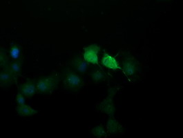SOLO / SESTD1 Antibody - Anti-SESTD1 mouse monoclonal antibody immunofluorescent staining of COS7 cells transiently transfected by pCMV6-ENTRY SESTD1.