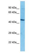 solute carrier family 35, member E2B (SLC35E2B), transcript variant 1 Antibody - SLC35E2B antibody Western Blot of Jurkat. Antibody dilution: 1 ug/ml.  This image was taken for the unconjugated form of this product. Other forms have not been tested.