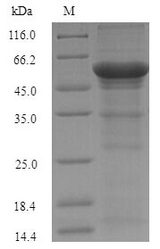 uxuA Protein - (Tris-Glycine gel) Discontinuous SDS-PAGE (reduced) with 5% enrichment gel and 15% separation gel.