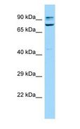 SORBS1 / Ponsin Antibody - SORBS1 / Ponsin antibody Western Blot of Mouse Testis.  This image was taken for the unconjugated form of this product. Other forms have not been tested.