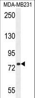 SORBS1 / Ponsin Antibody - SORBS1 Antibody western blot of MDA-MB231 cell line lysates (35 ug/lane). The SORBS1 antibody detected the SORBS1 protein (arrow).