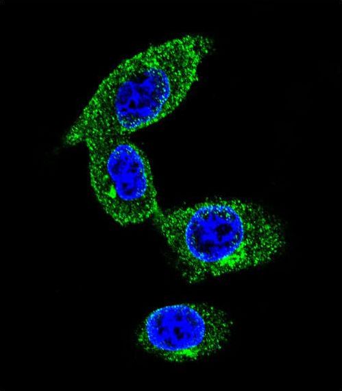 SORBS1 / Ponsin Antibody - Confocal immunofluorescence of SORBS1 Antibody with MDA-MB231 cell followed by Alexa Fluor 488-conjugated goat anti-rabbit lgG (green). DAPI was used to stain the cell nuclear (blue).