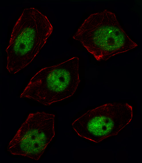 SORBS2 / ARGBP2 Antibody - Fluorescent image of U251 cell stained with ARGBP2 Antibody. U251 cells were fixed with 4% PFA (20 min), permeabilized with Triton X-100 (0.1%, 10 min), then incubated with ARGBP2 primary antibody (1:25, 1 h at 37°C). For secondary antibody, Alexa Fluor 488 conjugated donkey anti-rabbit antibody (green) was used (1:400, 50 min at 37°C). Cytoplasmic actin was counterstained with Alexa Fluor 555 (red) conjugated Phalloidin (7units/ml, 1 h at 37°C). ARGBP2 immunoreactivity is localized to Nucleus significantly.