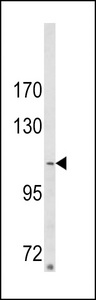 SORBS2 / ARGBP2 Antibody - Western blot of ARGBP2 Antibody in MDA-MB231 cell line lysates (35 ug/lane). ARGBP2 (arrow) was detected using the purified antibody.