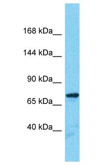 SORBS2 / ARGBP2 Antibody - SORBS2 / ARGBP2 antibody Western Blot of Fetal Kidney. Antibody dilution: 1 ug/ml.  This image was taken for the unconjugated form of this product. Other forms have not been tested.